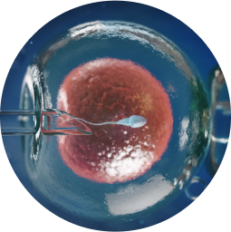 Fécondation par ICSI